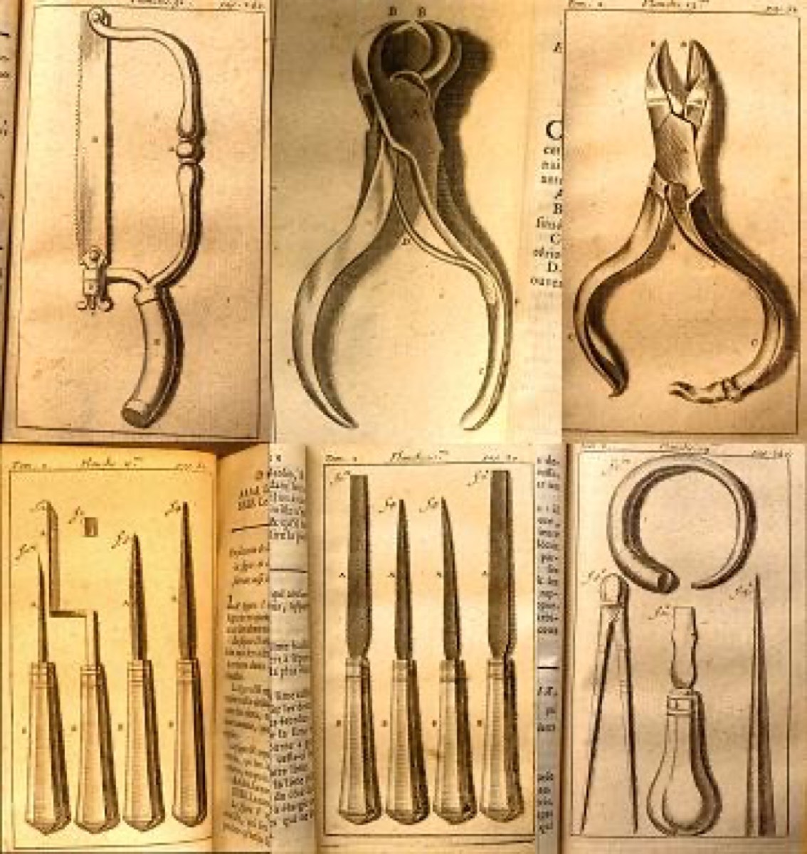 Instrumentos dentales diseñados por Pierre Fauchard